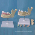 Estrutura de localização do dente humano Modelo de anatomia para o ensino (R080113)
